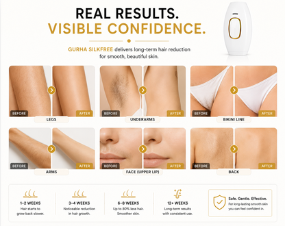 Gurha SilkFree- IPL Laser hair removal machine